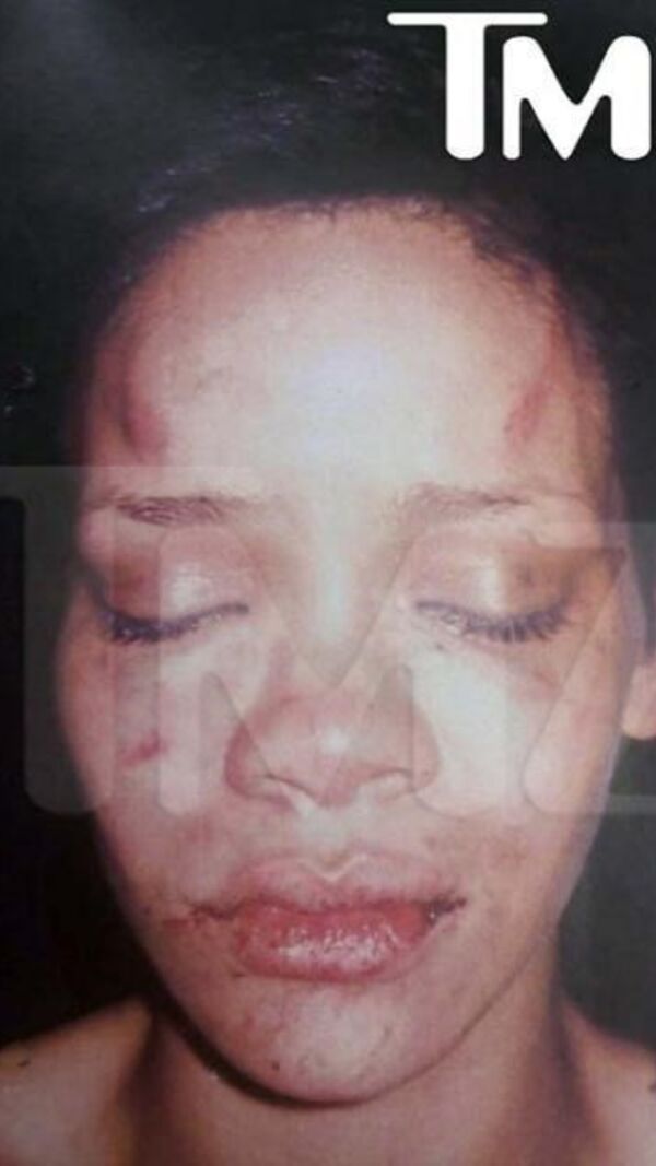 agressão de Chris Brown a Rihanna