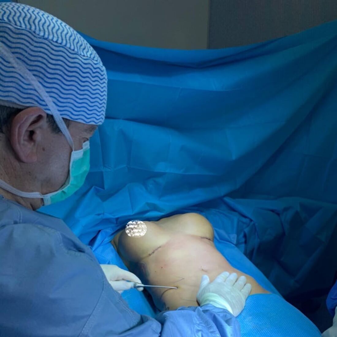 Érica Silva, casa dos segredos 4, tvi, cirurgia plástica, bloco operatório, José Moreira Martins