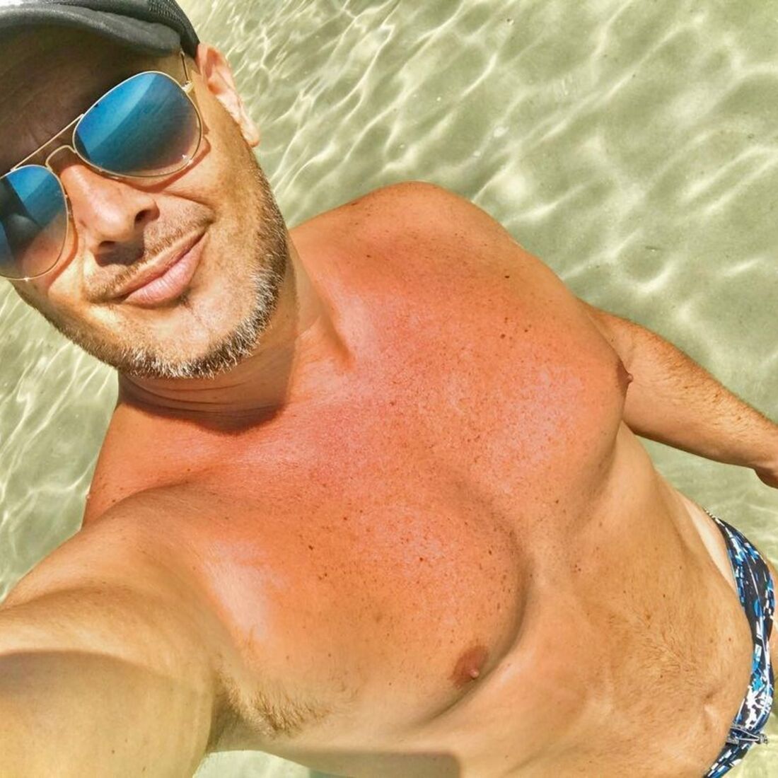 melão