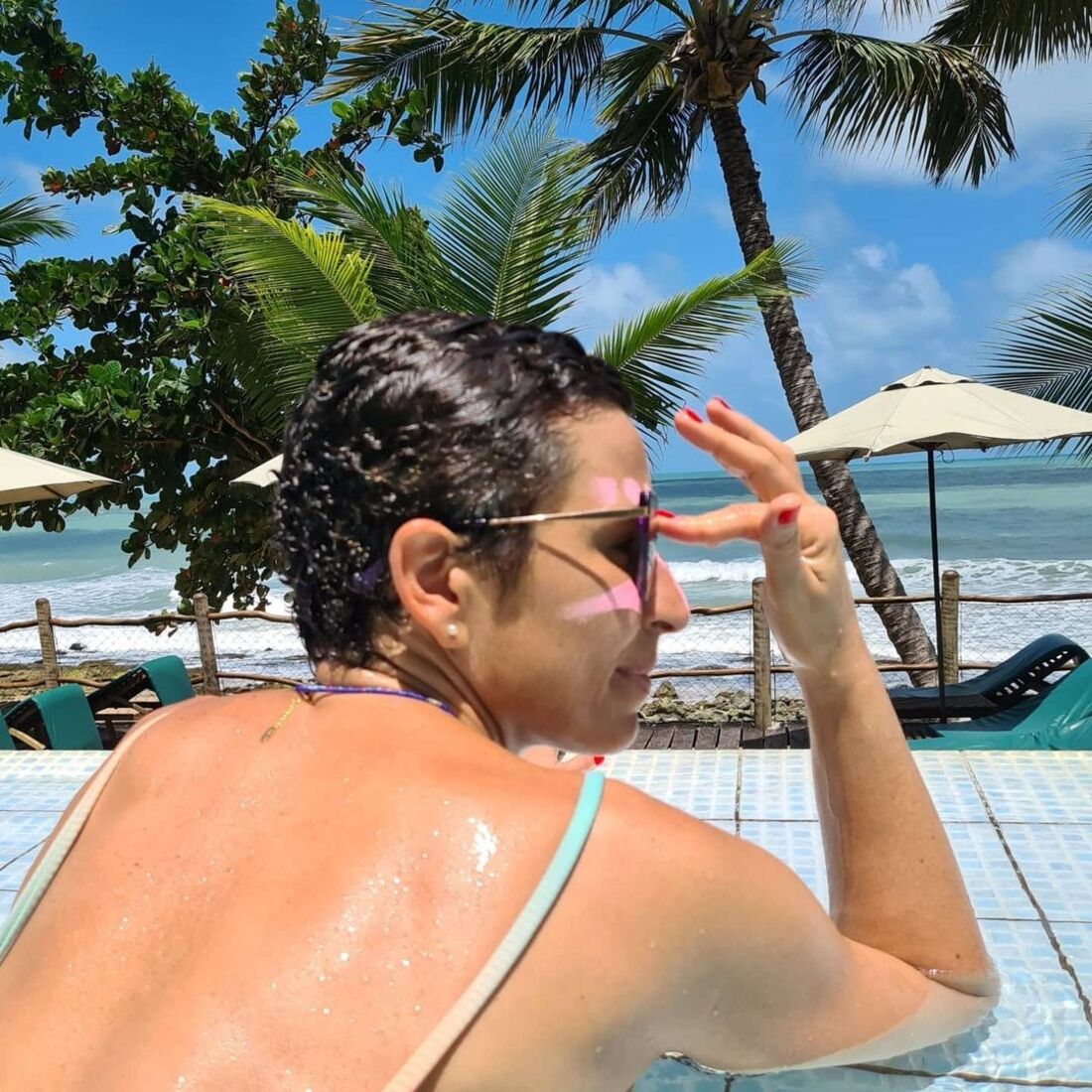 Joana passou mostrou aos seguidores a cicatriz que a cirurgia deixou, com uma mensagem: 'Marcas da batalha vencida. A operação que me puxou músculo das costas para a frente deixou uma cicatriz que merece honras de protetor cor de rosa'