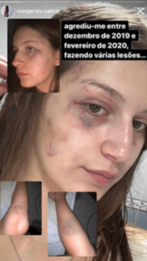 Margarida Castro, agressões