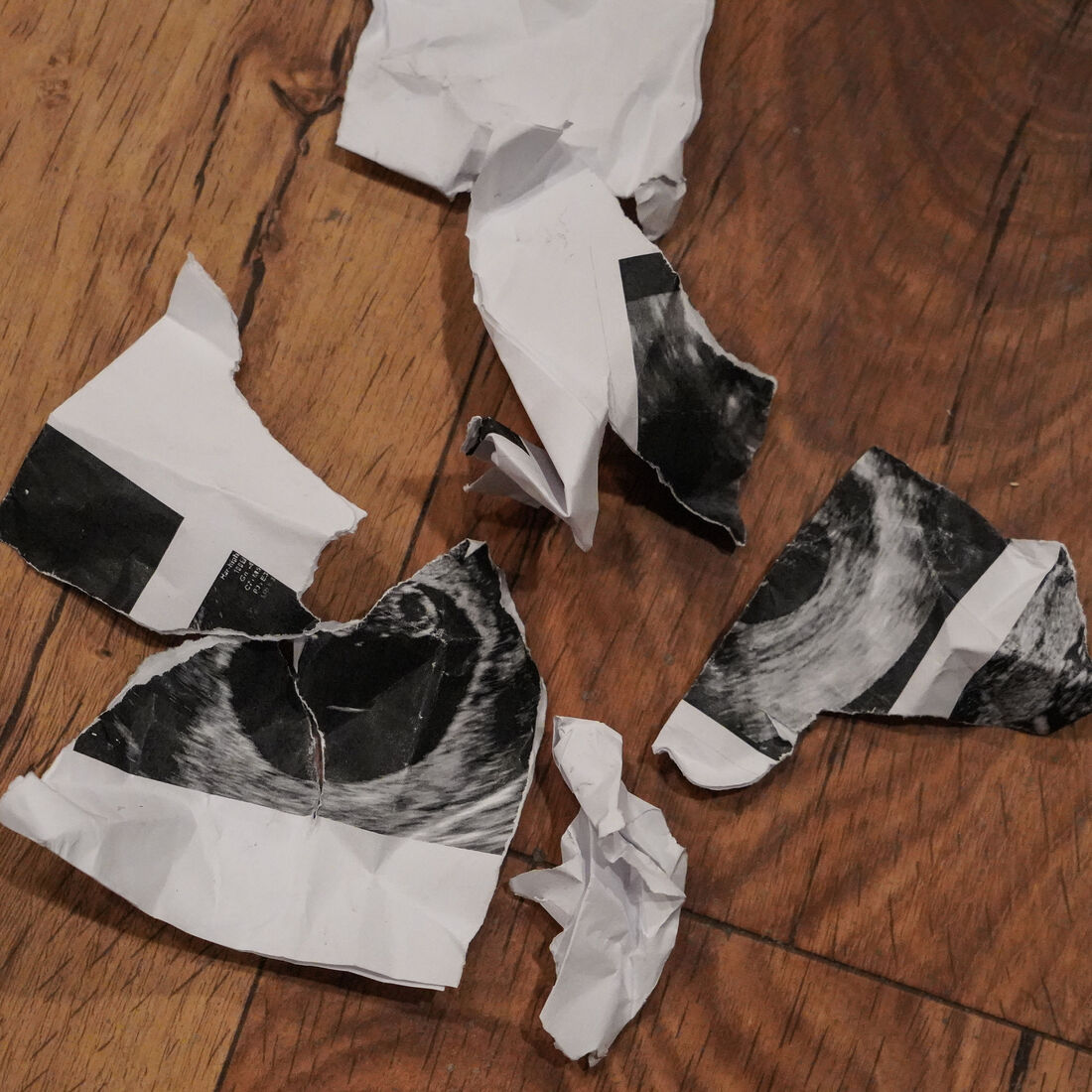 'A Promessa': ecografia