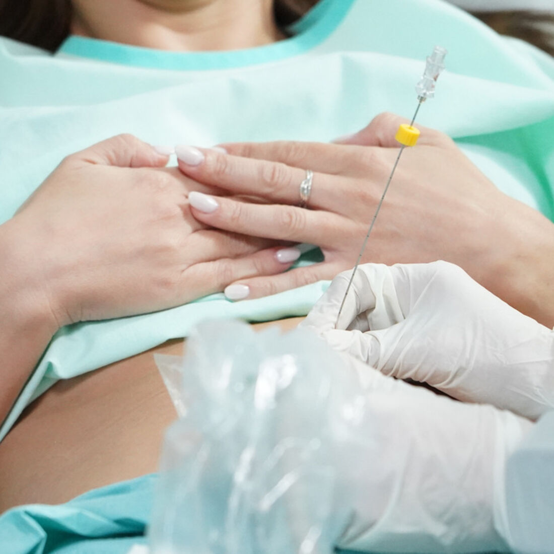 Inês faz amniocentese para provar a Pedro que está grávida dele e não de Vicente